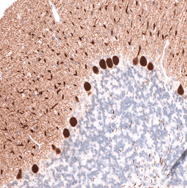 Calbindin D-28K Antibody (CL15065) - Azide and BSA Free Immunohistochemistry-Paraffin: Calbindin D-28K Antibody [NBP3-43925]