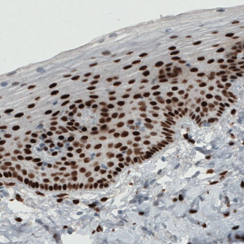 ER alpha/NR3A1 Antibody (CL1196) - Azide and BSA Free Immunohistochemistry-Paraffin: ER alpha/NR3A1 Antibody [NBP3-43926]