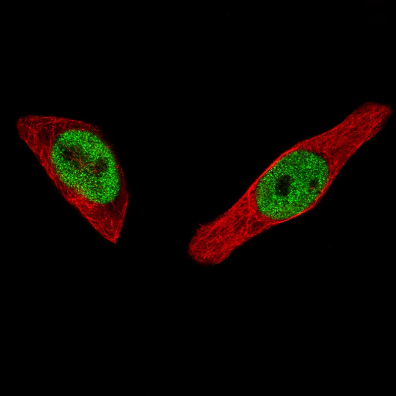 ER alpha/NR3A1 Antibody (CL1196) - Azide and BSA Free Immunocytochemistry/ Immunofluorescence: ER alpha/NR3A1 Antibody [NBP3-43926]