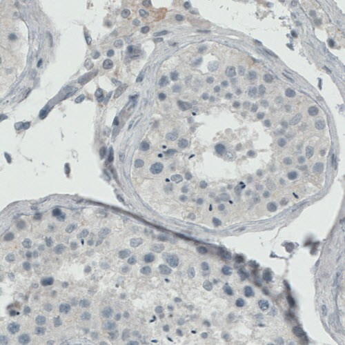 ER alpha/NR3A1 Antibody (CL1196) - Azide and BSA Free Immunohistochemistry-Paraffin: ER alpha/NR3A1 Antibody [NBP3-43926]
