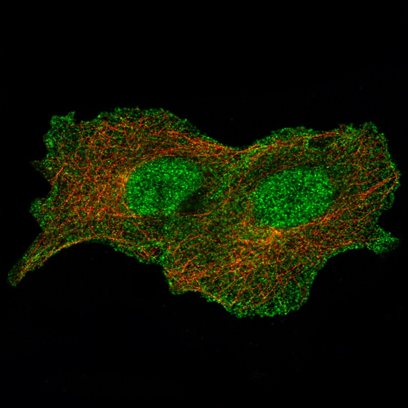Annexin A1 Antibody (CL0199) - Azide and BSA Free Immunocytochemistry/ Immunofluorescence: Annexin A1 Antibody [NBP3-43928]