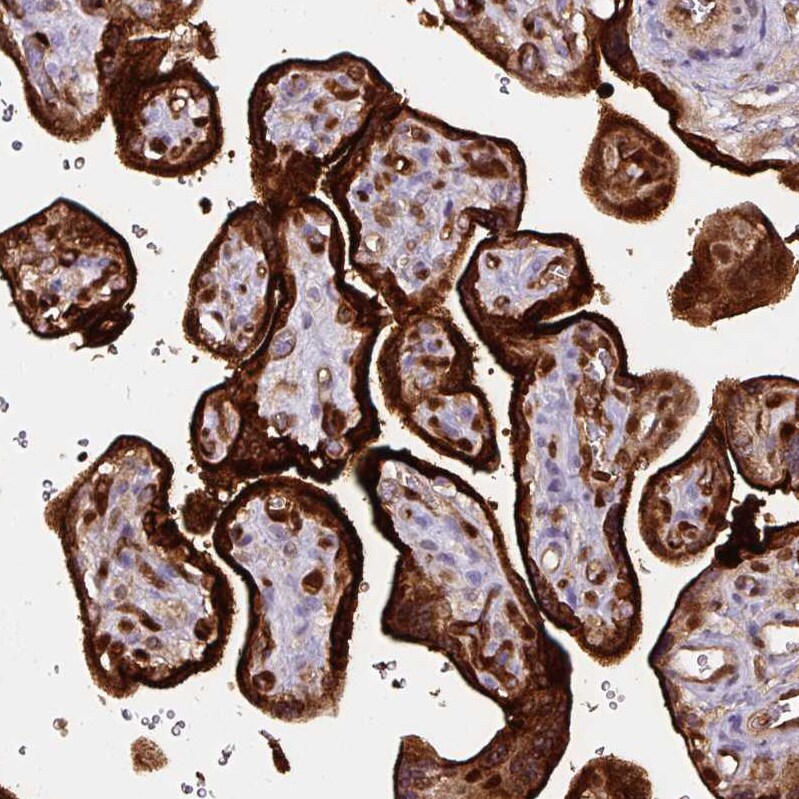 Annexin A1 Antibody (CL0199) - Azide and BSA Free Immunohistochemistry-Paraffin: Annexin A1 Antibody [NBP3-43928]