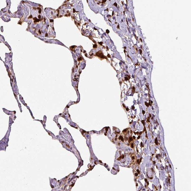 Annexin A1 Antibody (CL0199) - Azide and BSA Free Immunohistochemistry-Paraffin: Annexin A1 Antibody [NBP3-43928]