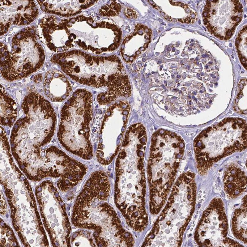 MACC1 Antibody (CL0856) - Azide and BSA Free Immunohistochemistry-Paraffin: MACC1 Antibody [NBP3-43929]