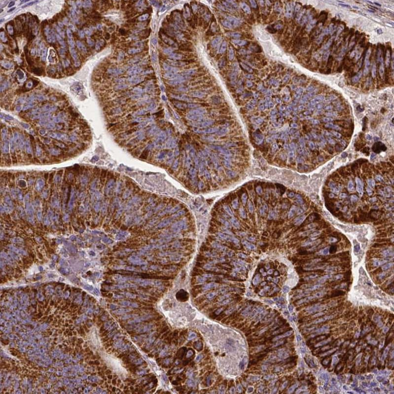 MACC1 Antibody (CL0856) - Azide and BSA Free Immunohistochemistry-Paraffin: MACC1 Antibody [NBP3-43929]