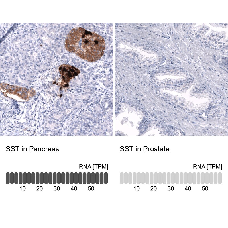 Somatostatin Antibody (CL15075) - Azide and BSA Free Immunohistochemistry-Paraffin: Somatostatin Antibody [NBP3-43930]
