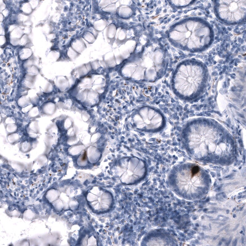 Somatostatin Antibody (CL15075) - Azide and BSA Free Immunohistochemistry-Paraffin: Somatostatin Antibody [NBP3-43930]