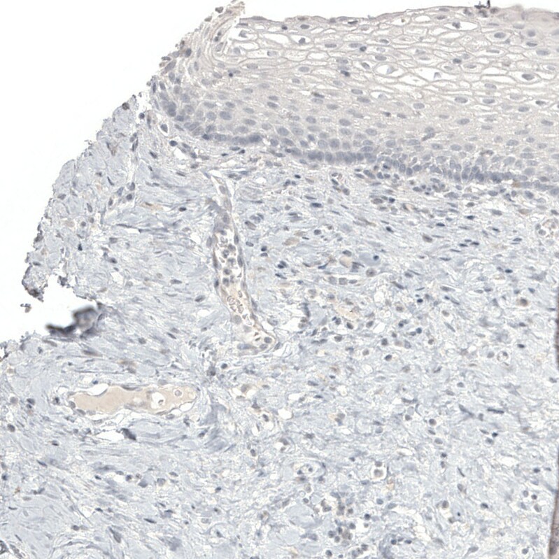 Melan-A/MART-1 Antibody (CL12864) - Azide and BSA Free Immunohistochemistry-Paraffin: Melan-A/MART-1 Antibody [NBP3-43932]