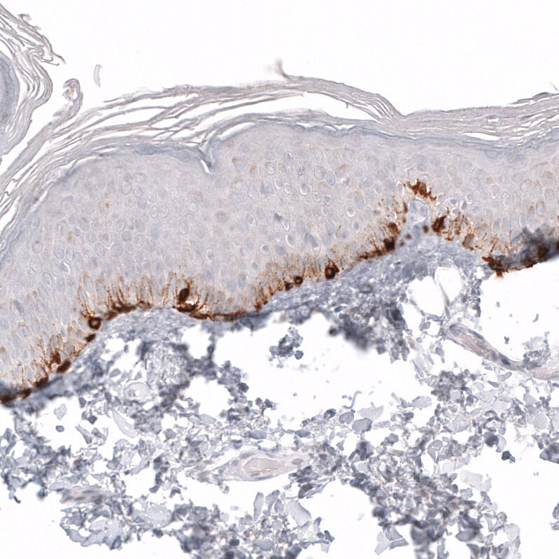 Melan-A/MART-1 Antibody (CL12864) - Azide and BSA Free Immunohistochemistry-Paraffin: Melan-A/MART-1 Antibody [NBP3-43932]