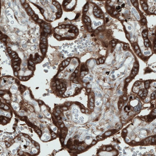 DIAPH-2 Antibody (CL1111) - Azide and BSA Free Immunohistochemistry-Paraffin: DIAPH-2 Antibody [NBP3-43934]