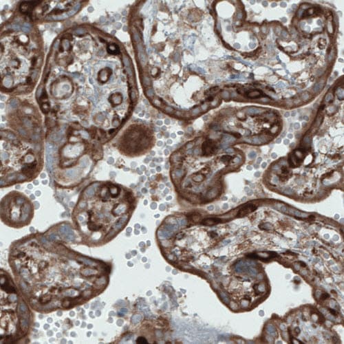 DIAPH-2 Antibody (CL1113) - Azide and BSA Free Immunohistochemistry-Paraffin: DIAPH-2 Antibody [NBP3-43935]
