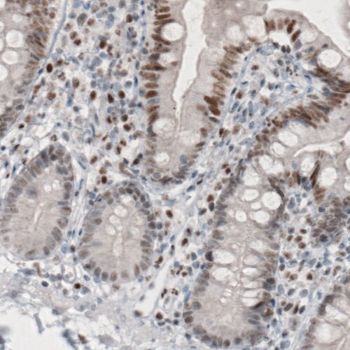 TLE3 Antibody (CL3573) - Azide and BSA Free Immunohistochemistry-Paraffin: TLE3 Antibody [NBP3-43936]