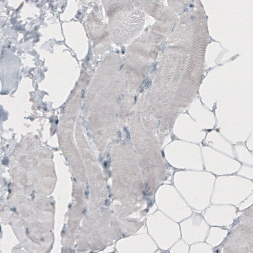 TLE3 Antibody (CL3573) - Azide and BSA Free Immunohistochemistry-Paraffin: TLE3 Antibody [NBP3-43936]