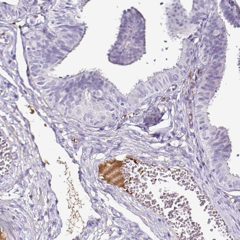 Transthyretin/Prealbumin Antibody (CL0290) - Azide and BSA Free Immunohistochemistry-Paraffin: Transthyretin/Prealbumin Antibody [NBP3-43937]