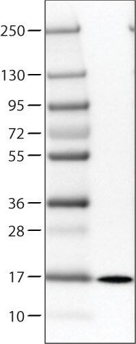 Transthyretin/Prealbumin Antibody (CL0290) - Azide and BSA Free Western Blot: Transthyretin/Prealbumin Antibody [NBP3-43937]