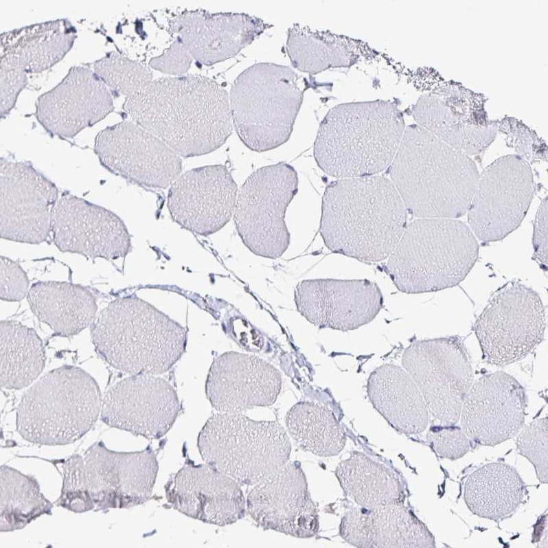 Transthyretin/Prealbumin Antibody (CL0290) - Azide and BSA Free Immunohistochemistry-Paraffin: Transthyretin/Prealbumin Antibody [NBP3-43937]