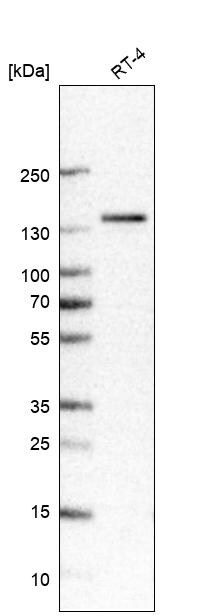 TRPM4 Antibody (CL11214) - Azide and BSA Free Western Blot: TRPM4 Antibody [NBP3-43938]