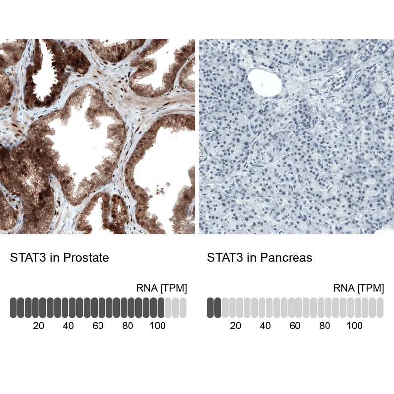 STAT3 Antibody (CL0490) - Azide and BSA Free Immunohistochemistry-Paraffin: STAT3 Antibody [NBP3-43940]
