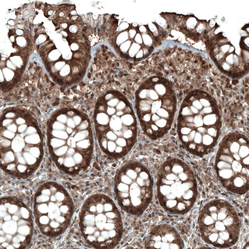 STAT3 Antibody (CL0492) - Azide and BSA Free Immunohistochemistry-Paraffin: STAT3 Antibody [NBP3-43941]