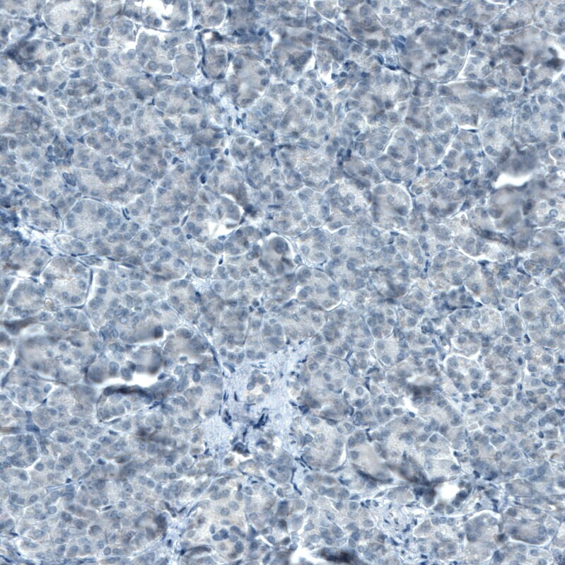 STAT3 Antibody (CL0492) - Azide and BSA Free Immunohistochemistry-Paraffin: STAT3 Antibody [NBP3-43941]