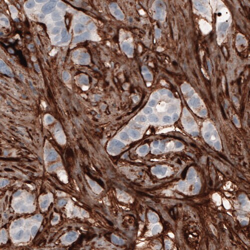 Fibronectin Antibody (CL3730) - Azide and BSA Free Immunohistochemistry-Paraffin: Fibronectin Antibody [NBP3-43942]
