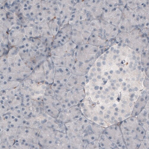 Fibronectin Antibody (CL3730) - Azide and BSA Free Immunohistochemistry-Paraffin: Fibronectin Antibody [NBP3-43942]