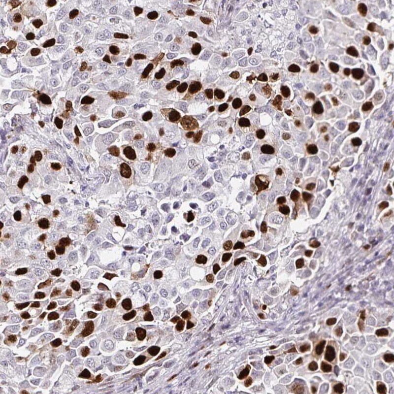 Anillin Antibody (CL0301) - Azide and BSA Free Immunohistochemistry-Paraffin: Anillin Antibody [NBP3-43944]