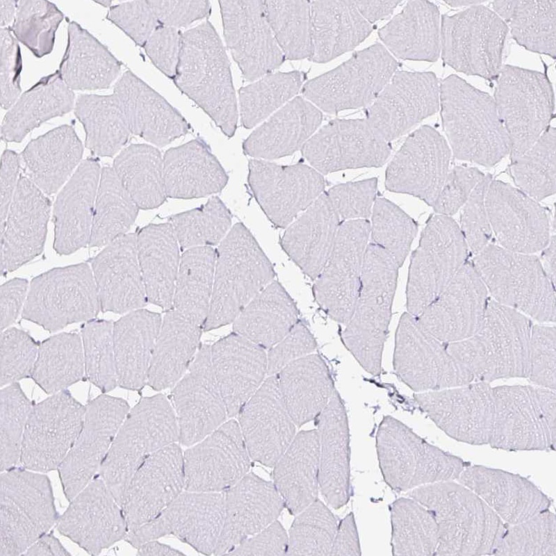 Anillin Antibody (CL0301) - Azide and BSA Free Immunohistochemistry-Paraffin: Anillin Antibody [NBP3-43944]