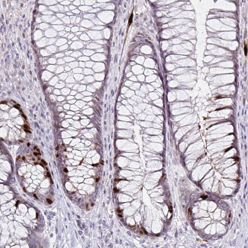 Anillin Antibody (CL0301) - Azide and BSA Free Immunohistochemistry-Paraffin: Anillin Antibody [NBP3-43944]