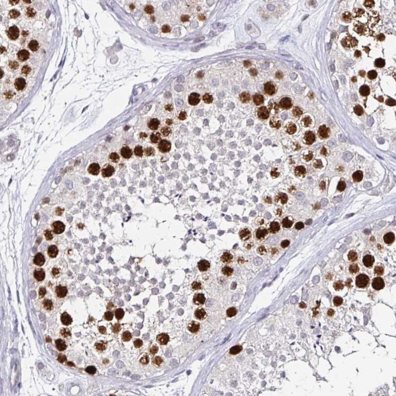 Anillin Antibody (CL0301) - Azide and BSA Free Immunohistochemistry-Paraffin: Anillin Antibody [NBP3-43944]