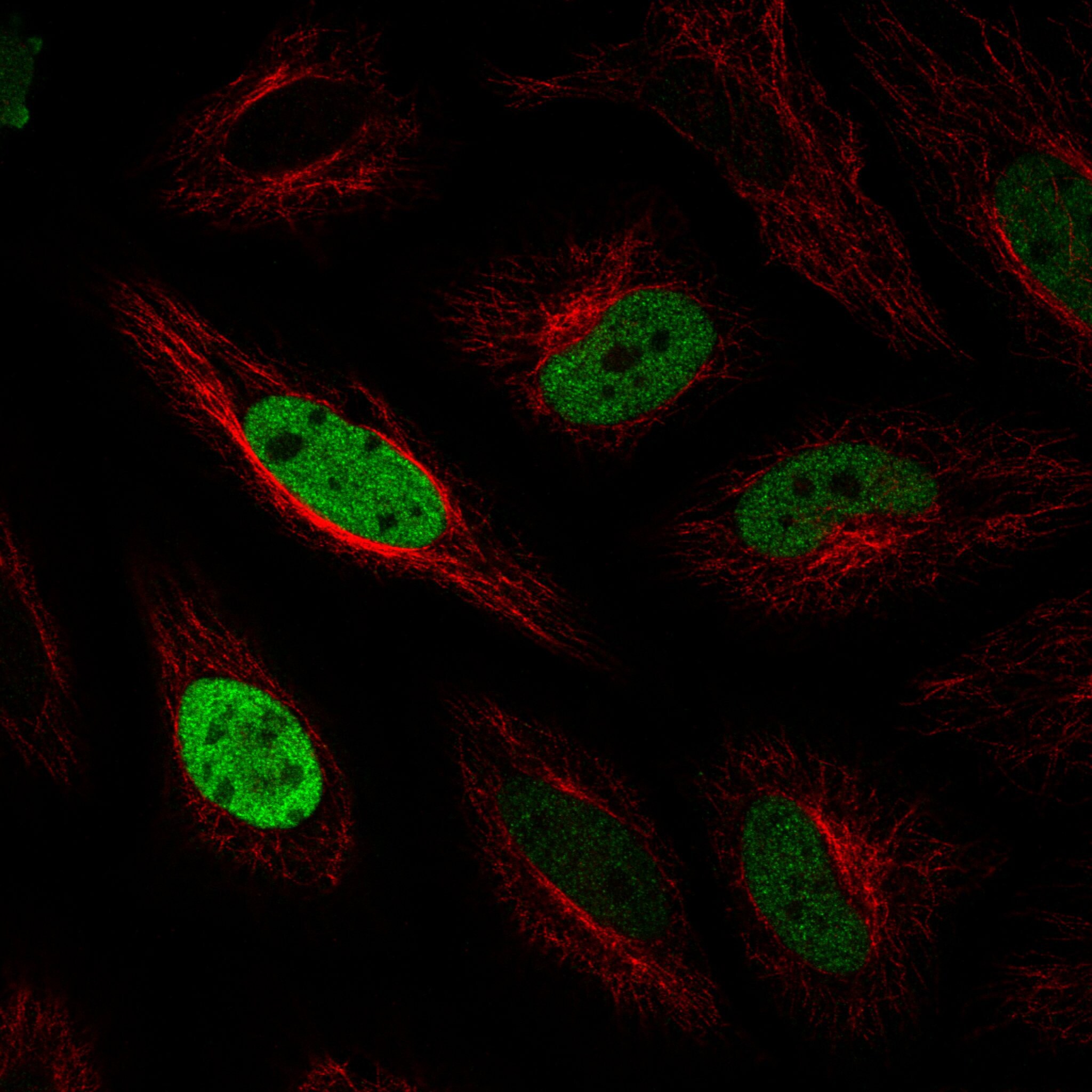 Anillin Antibody (CL0303) - Azide and BSA Free Immunocytochemistry/ Immunofluorescence: Anillin Antibody [NBP3-43945]
