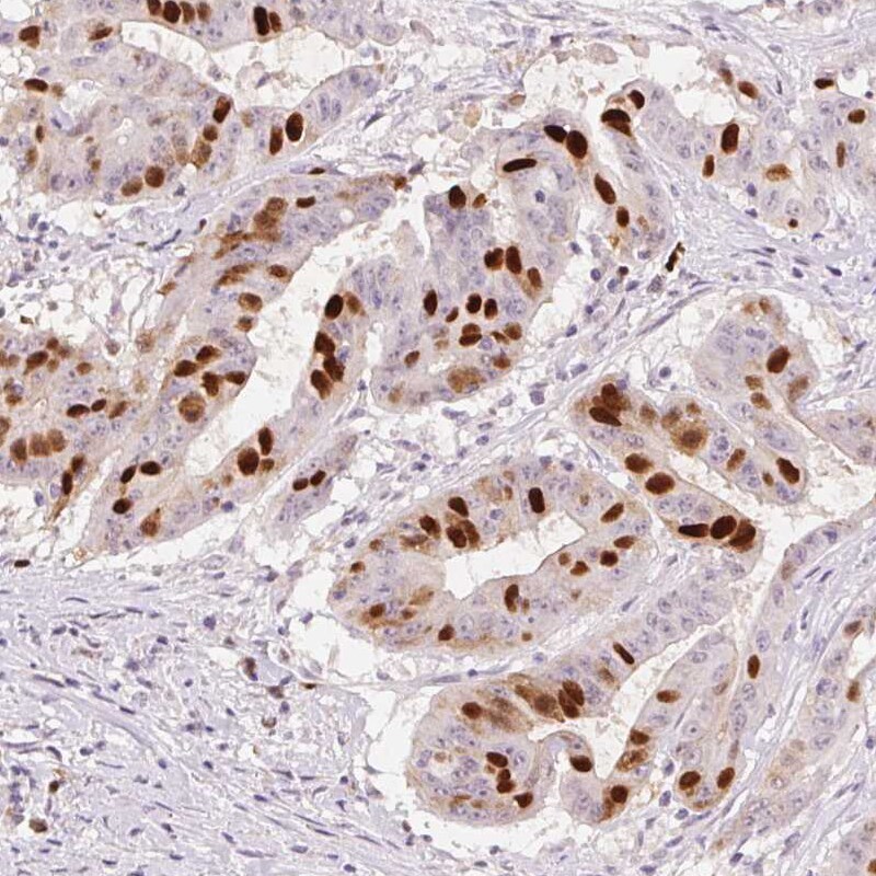 Anillin Antibody (CL0303) - Azide and BSA Free Immunohistochemistry-Paraffin: Anillin Antibody [NBP3-43945]
