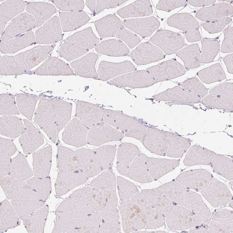 Anillin Antibody (CL0303) - Azide and BSA Free Immunohistochemistry-Paraffin: Anillin Antibody [NBP3-43945]