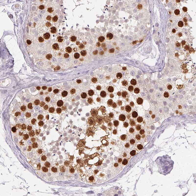 Anillin Antibody (CL0303) - Azide and BSA Free Immunohistochemistry-Paraffin: Anillin Antibody [NBP3-43945]