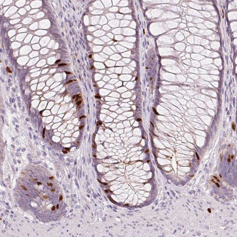 Anillin Antibody (CL0303) - Azide and BSA Free Immunohistochemistry-Paraffin: Anillin Antibody [NBP3-43945]