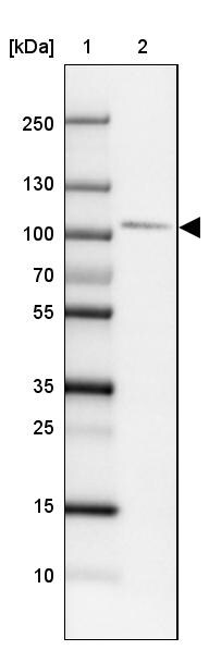 SATB2 Antibody (CL0319) - Azide and BSA Free Western Blot: SATB2 Antibody [NBP3-43946]