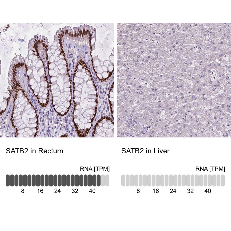 SATB2 Antibody (CL0319) - Azide and BSA Free Immunohistochemistry-Paraffin: SATB2 Antibody [NBP3-43946]