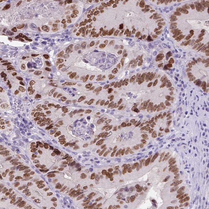SATB2 Antibody (CL0319) - Azide and BSA Free Immunohistochemistry-Paraffin: SATB2 Antibody [NBP3-43946]