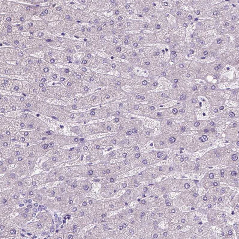SATB2 Antibody (CL0319) - Azide and BSA Free Immunohistochemistry-Paraffin: SATB2 Antibody [NBP3-43946]