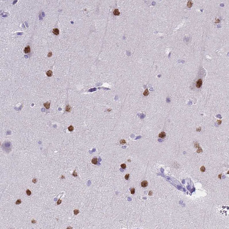 SATB2 Antibody (CL0319) - Azide and BSA Free Immunohistochemistry-Paraffin: SATB2 Antibody [NBP3-43946]
