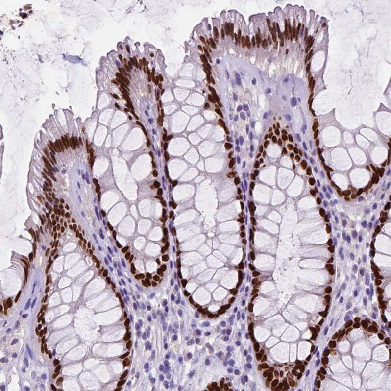 SATB2 Antibody (CL0319) - Azide and BSA Free Immunohistochemistry-Paraffin: SATB2 Antibody [NBP3-43946]