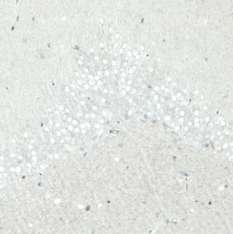 SATB2 Antibody (CL0319) - Azide and BSA Free Immunohistochemistry-Paraffin: SATB2 Antibody [NBP3-43946]