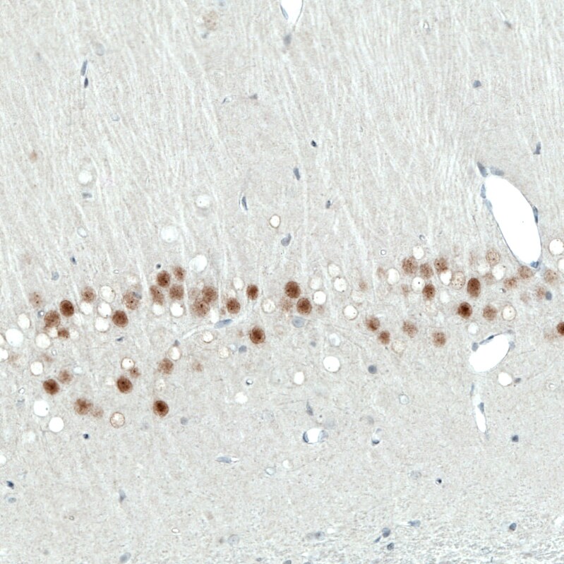 SATB2 Antibody (CL0319) - Azide and BSA Free Immunohistochemistry-Paraffin: SATB2 Antibody [NBP3-43946]