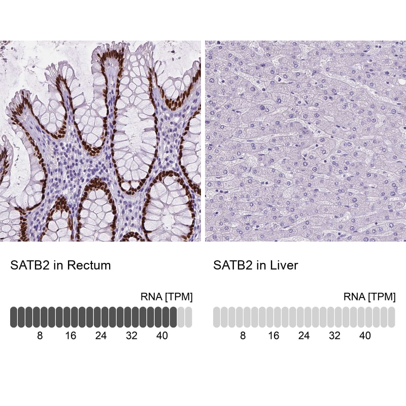 SATB2 Antibody (CL0320) - Azide and BSA Free Immunohistochemistry-Paraffin: SATB2 Antibody [NBP3-43947]