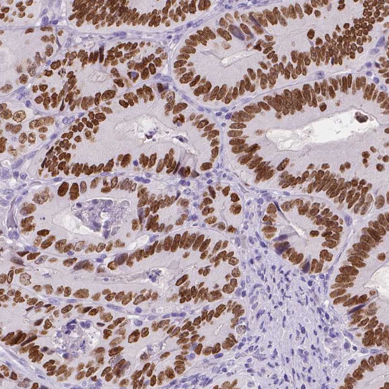 SATB2 Antibody (CL0320) - Azide and BSA Free Immunohistochemistry-Paraffin: SATB2 Antibody [NBP3-43947]