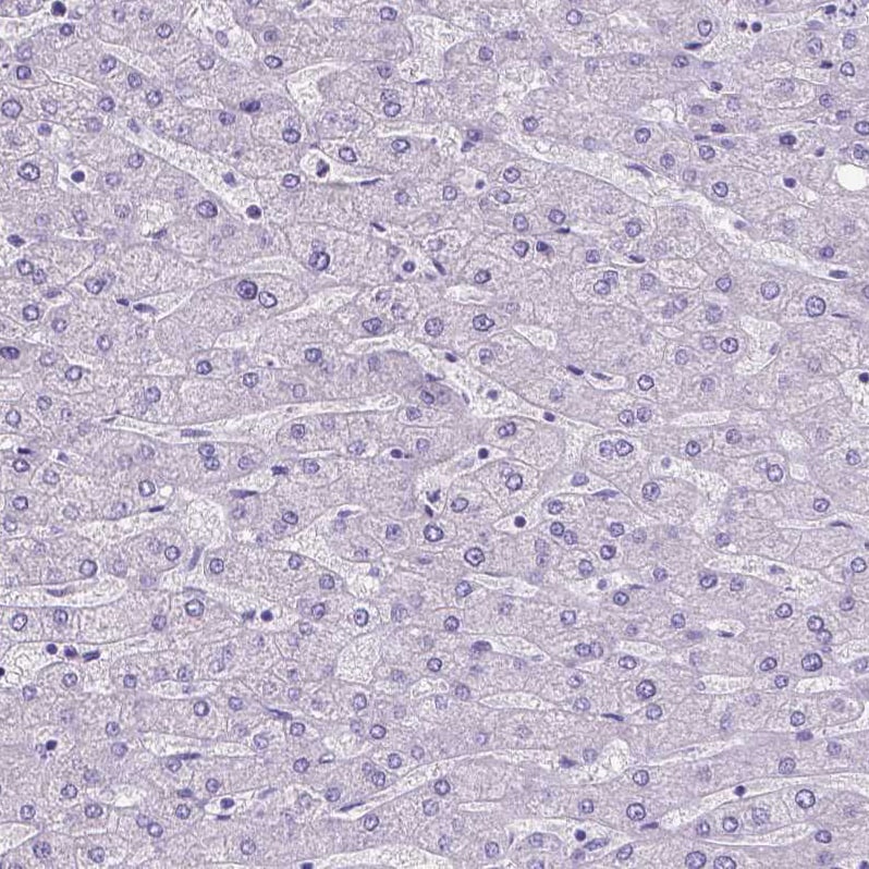 SATB2 Antibody (CL0320) - Azide and BSA Free Immunohistochemistry-Paraffin: SATB2 Antibody [NBP3-43947]