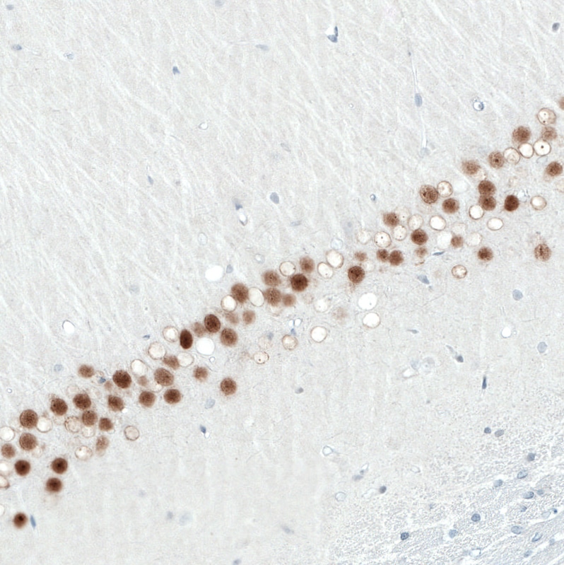 SATB2 Antibody (CL0320) - Azide and BSA Free Immunohistochemistry-Paraffin: SATB2 Antibody [NBP3-43947]