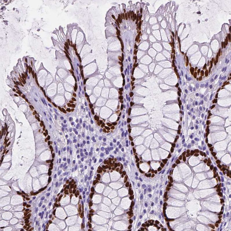 SATB2 Antibody (CL0320) - Azide and BSA Free Immunohistochemistry-Paraffin: SATB2 Antibody [NBP3-43947]