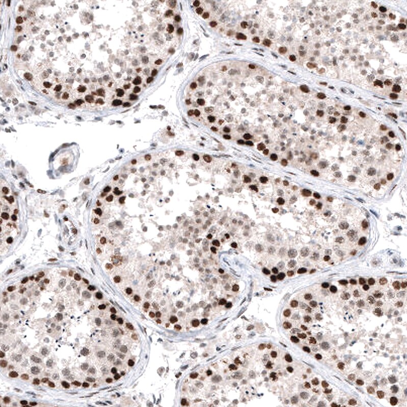 PI 3-Kinase p110 beta/PIK3CB Antibody (CL9518) - Azide and BSA Free Immunohistochemistry-Paraffin: PI 3-Kinase p110 beta/PIK3CB Antibody [NBP3-43948]