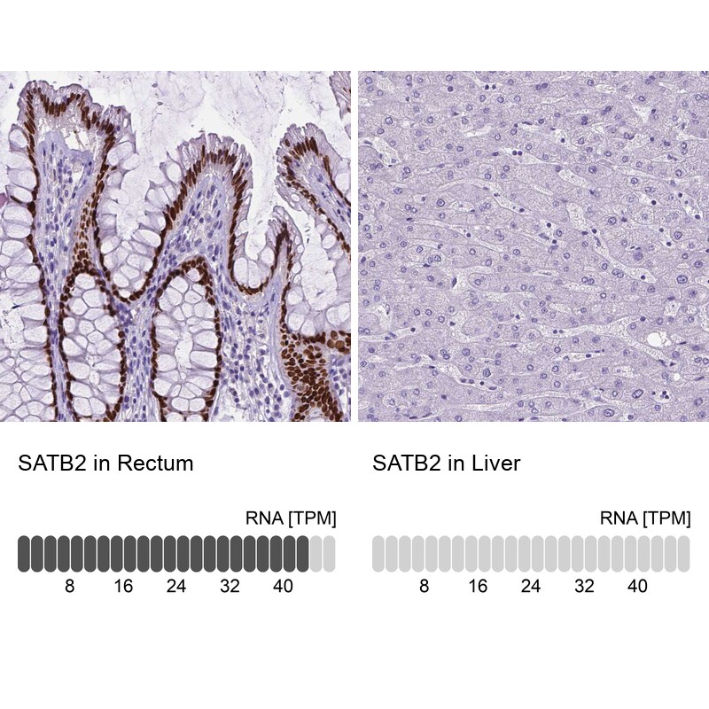 SATB2 Antibody (CL0321) - Azide and BSA Free Immunohistochemistry-Paraffin: SATB2 Antibody [NBP3-43949]